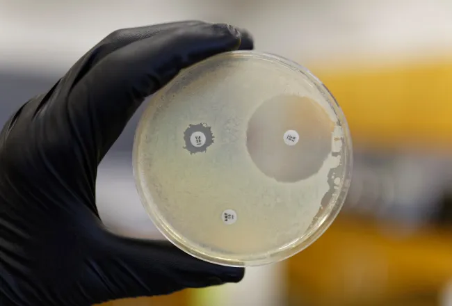 Boîte de Petri montrant la résistance d'une bactérie aux antibiotiques. Boîte de Petri montrant la résistance d'une bactérie aux antibiotiques. -Boîte de Petri montrant la résistance d'une bactérie aux antibiotiques. 