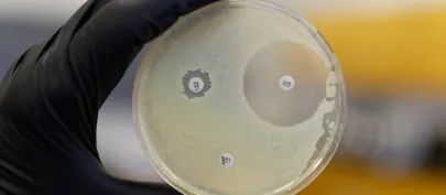 Boîte de Petri montrant la résistance d'une bactérie aux antibiotiques. Boîte de Petri montrant la résistance d'une bactérie aux antibiotiques. -Boîte de Petri montrant la résistance d'une bactérie aux antibiotiques. 