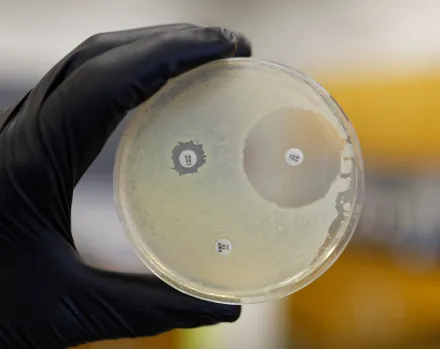 Boîte de Petri montrant la résistance d'une bactérie aux antibiotiques. Boîte de Petri montrant la résistance d'une bactérie aux antibiotiques. -Boîte de Petri montrant la résistance d'une bactérie aux antibiotiques. 